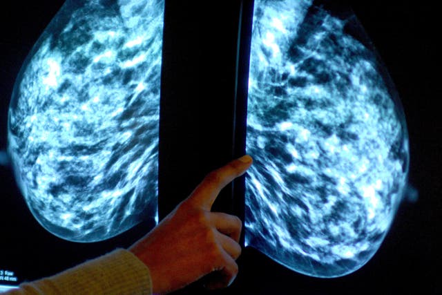 <p>A new study has enabled scientists to study breast tissue in detail outside the body (Rui Vieira/PA)</p>